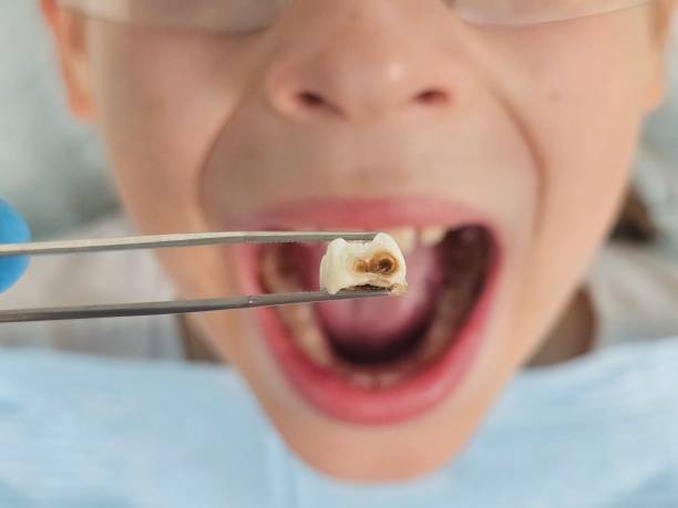 Best Emergency Care for Gum Disease in Marina, CA